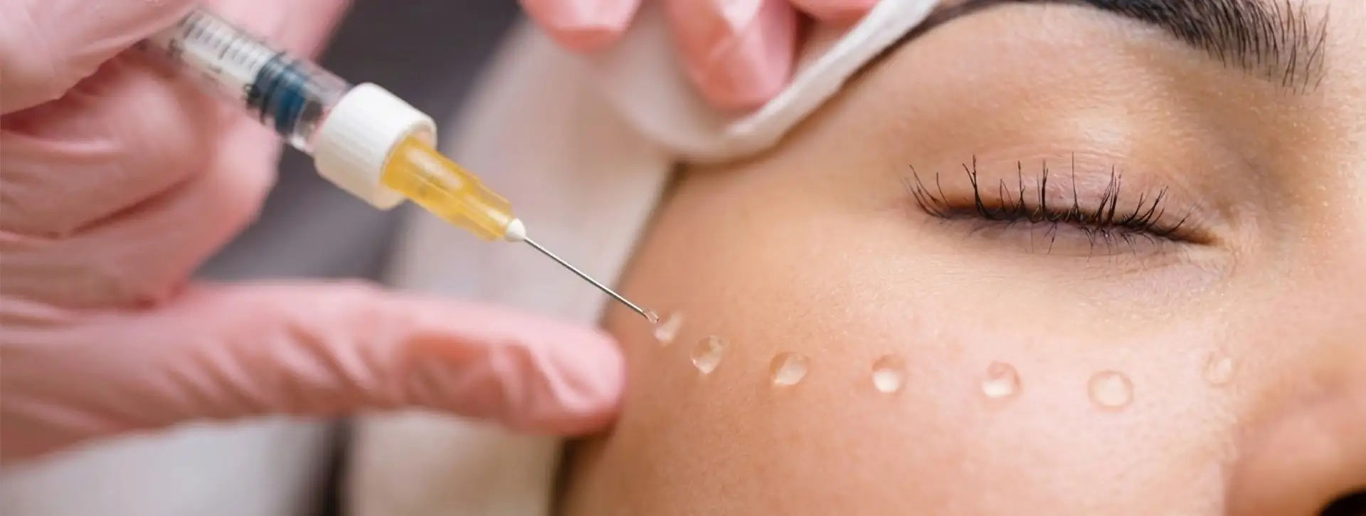 Skinboosters — Dermatologia Estética VOSS Dermatologia