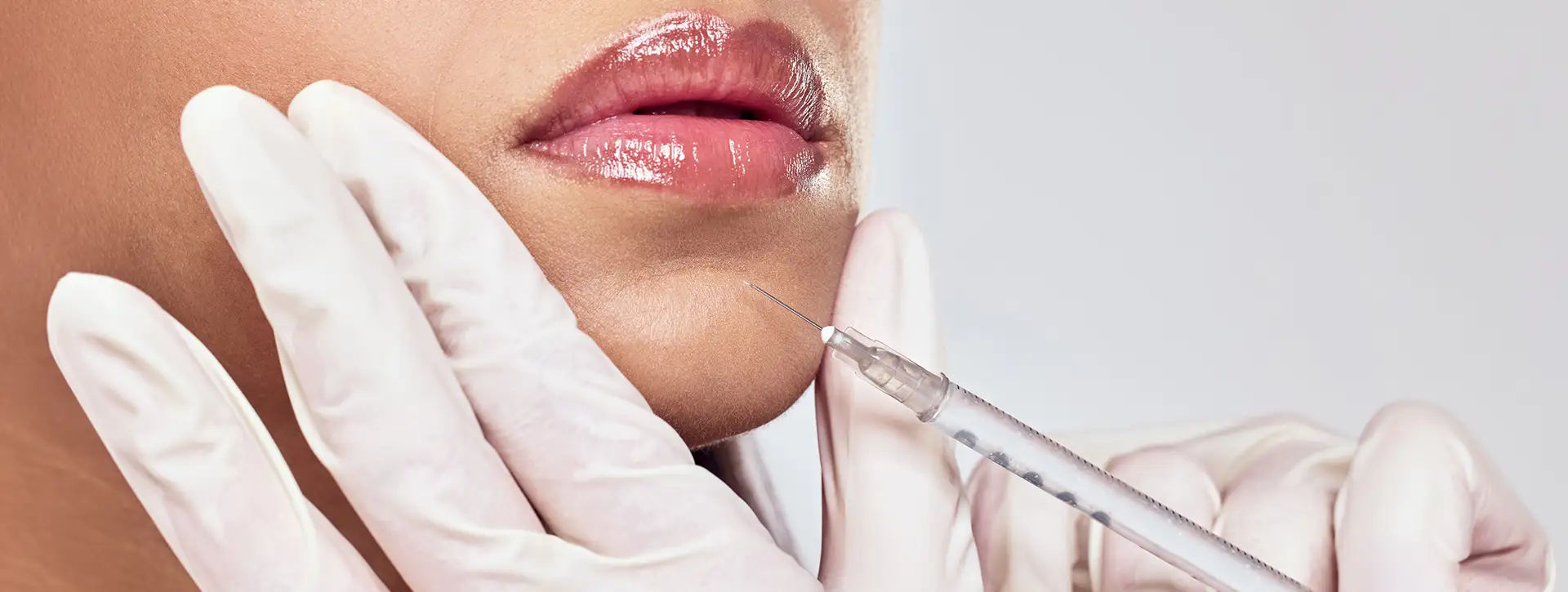 Preenchimento Labial e Preenchedores — Dermatologia Estética VOSS Dermatologia