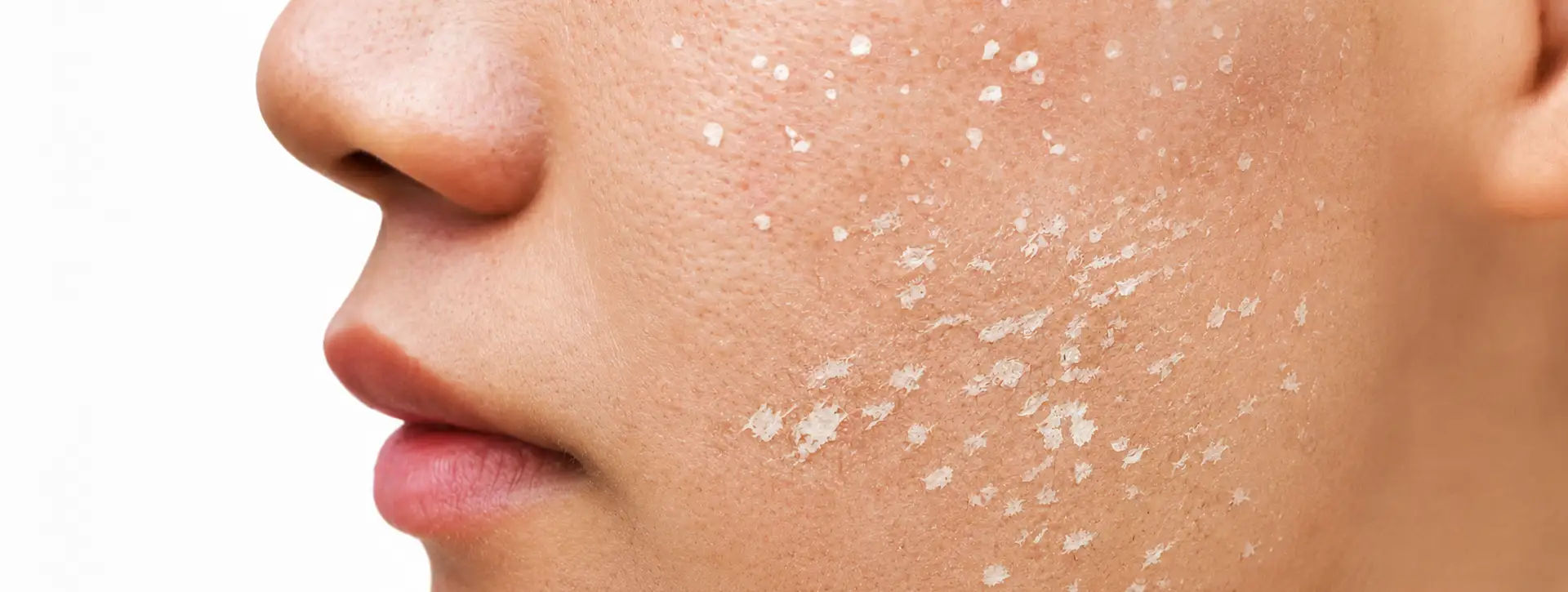 CROSS — Tecnologias e Inovações VOSS Dermatologia