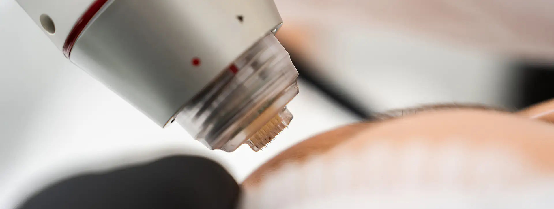 Laser Genesis — Tecnologias e Inovações VOSS Dermatologia