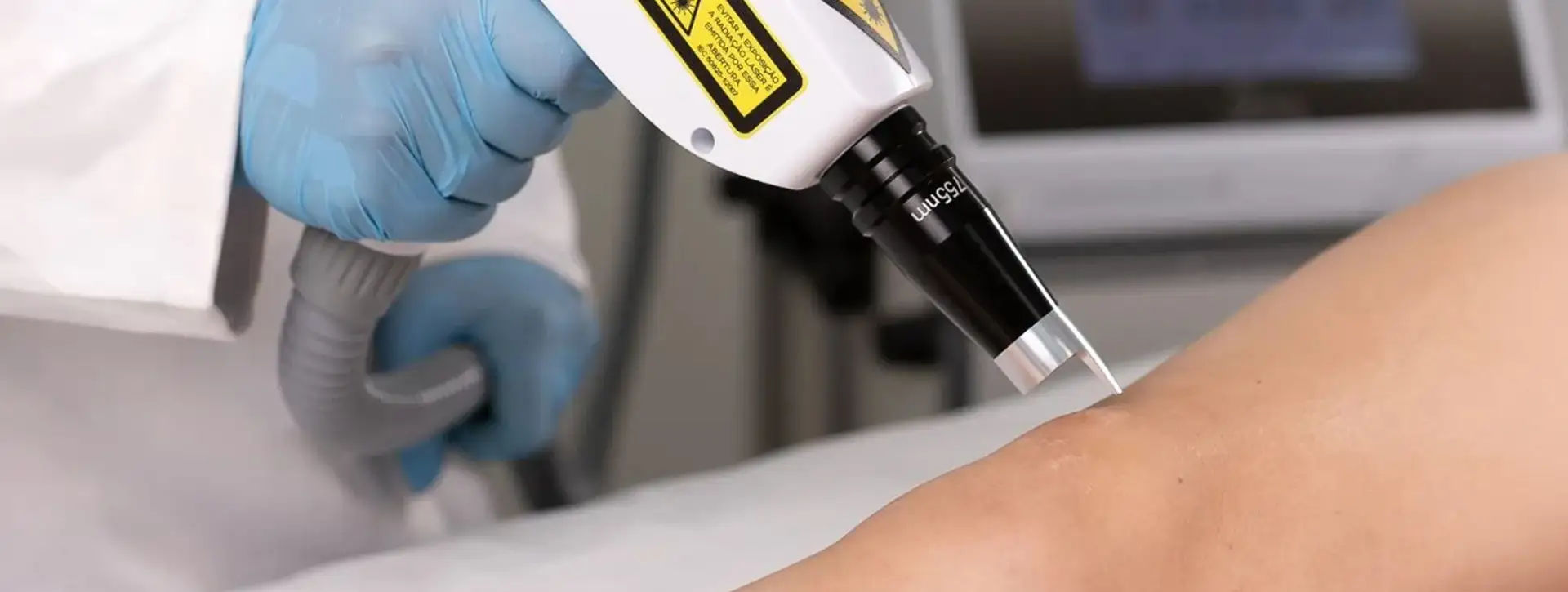 Laser Q-Switched Nd:YAG — Tecnologias e Inovações VOSS Dermatologia