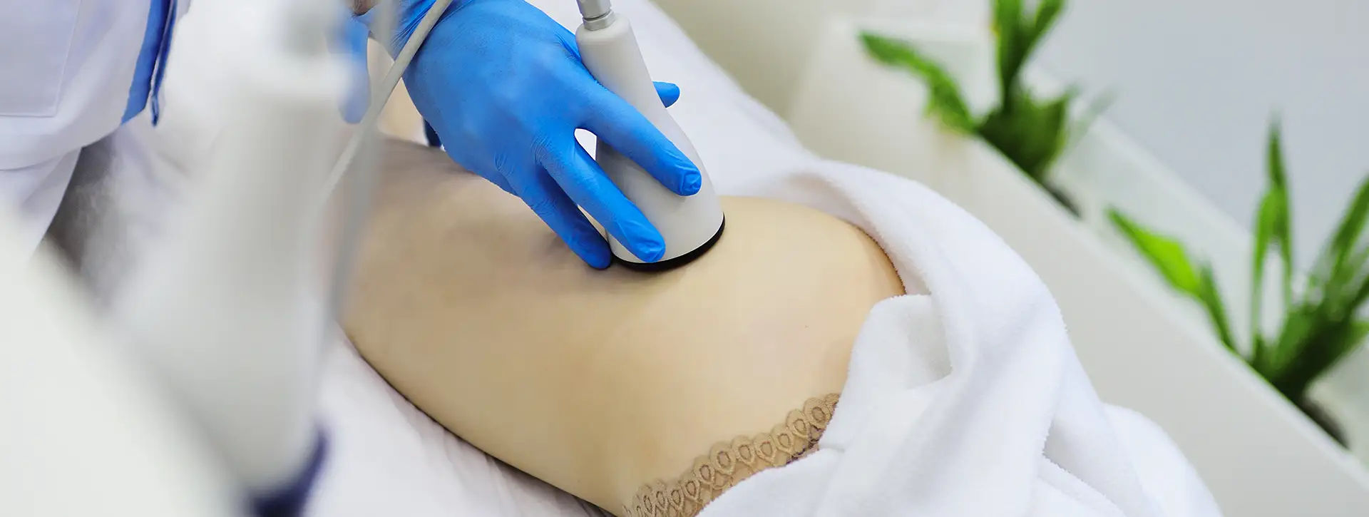 Ondas Acústicas (X-Wave) — Tecnologias e Inovações VOSS Dermatologia