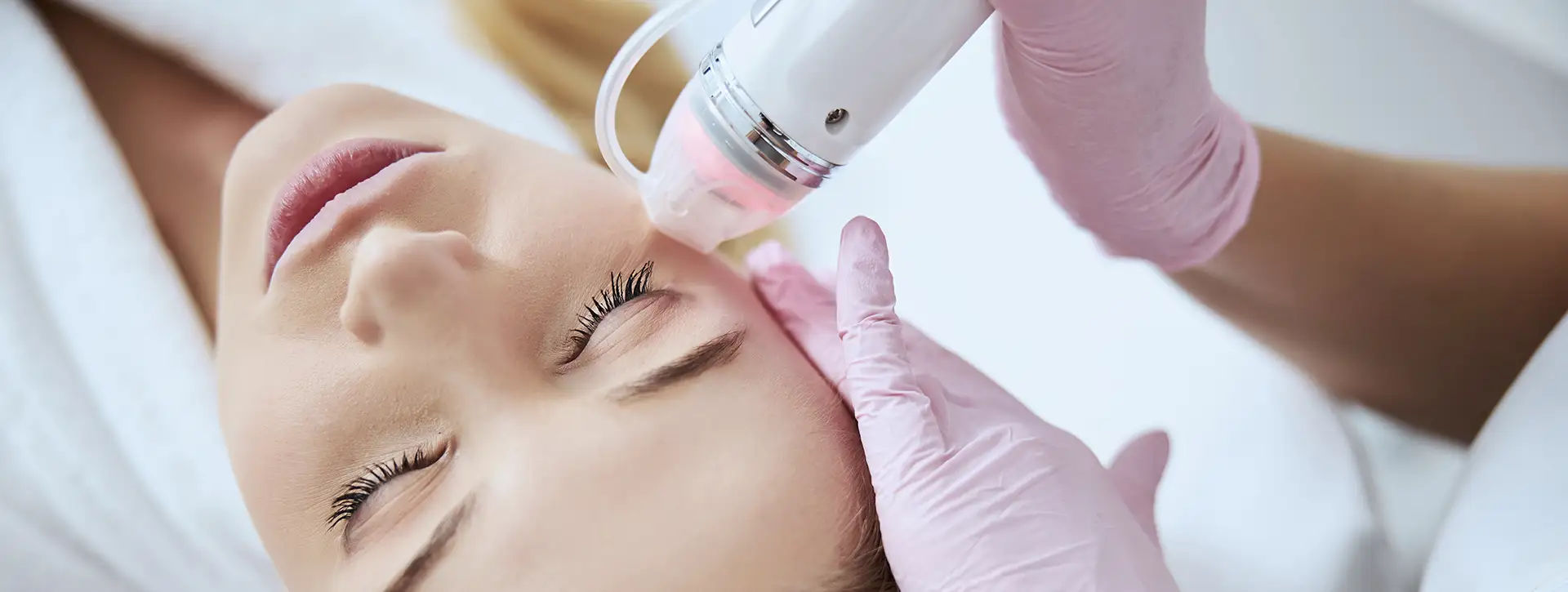 Virtue RF — Tecnologias e Inovações VOSS Dermatologia